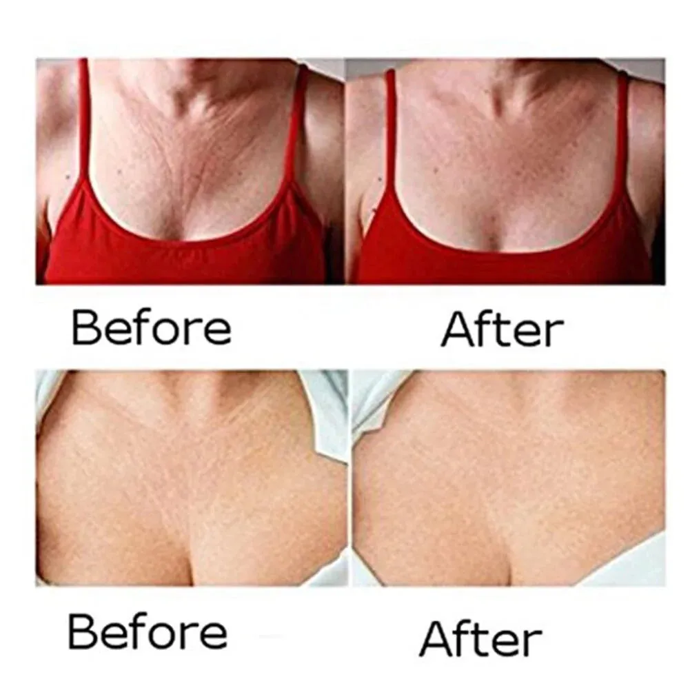 Smoothing Chest Wrinkle Pad